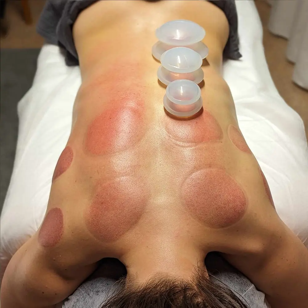 Trendrehab Cupping Therapy Set – Effektiv och avslappnande massage för hela kroppen